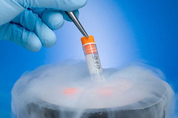 Sperm Freezing Best Fertility Center In Wakad Orion Hospital